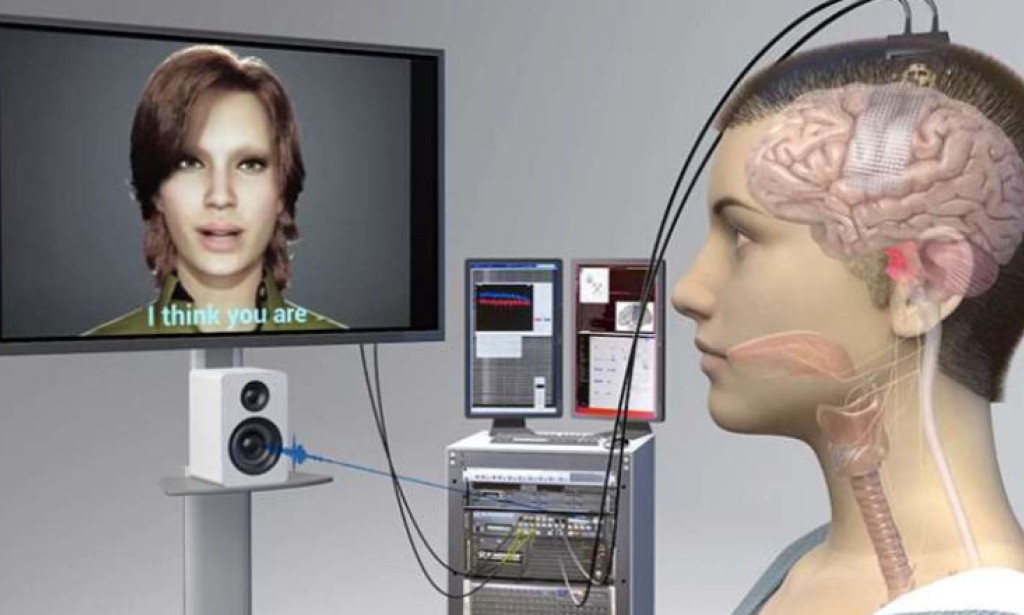 Yapay Zeka Destekli Beyin İmplantlarıyla Felçli Hastaların Düşünceleri Konuşmaya Dönüşüyor: Yeni Bir Ufuk Açılıyor