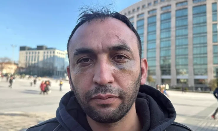 İstanbul'da Akılalmaz Tuzak: Sevgilisinin Evine Giren Adam Darp Edilip Gasp Edildi!